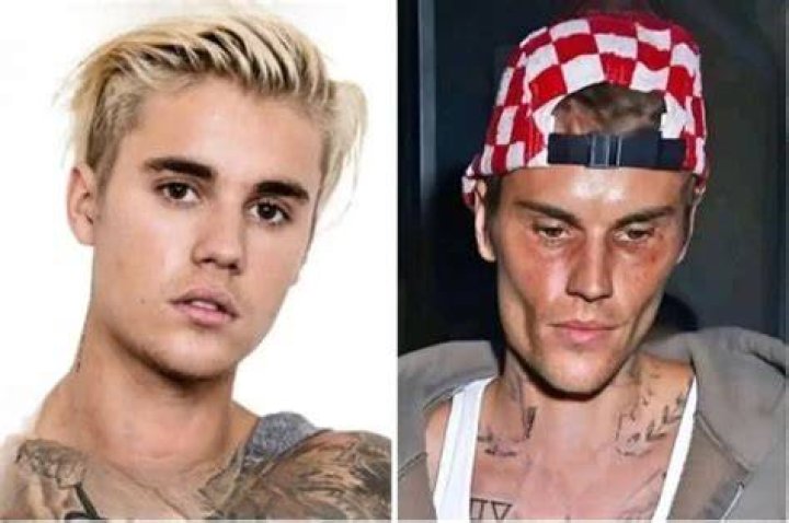 The Tragic Death Of Justin Bieber: A Loss For Music And The World